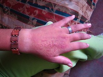 Eliah Pizarro Carbajal, otra mano