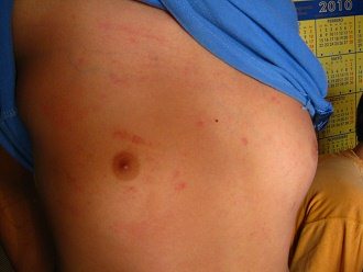 Diego Giovanni
              Astudillo Maib�, manchas