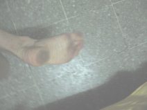 Inmediantemente tengo pies
                                    marrones en el cuarto del hostal
                                    Berlin