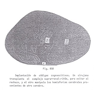 Fig. 85B: Implantaci�n de c�digos
                02