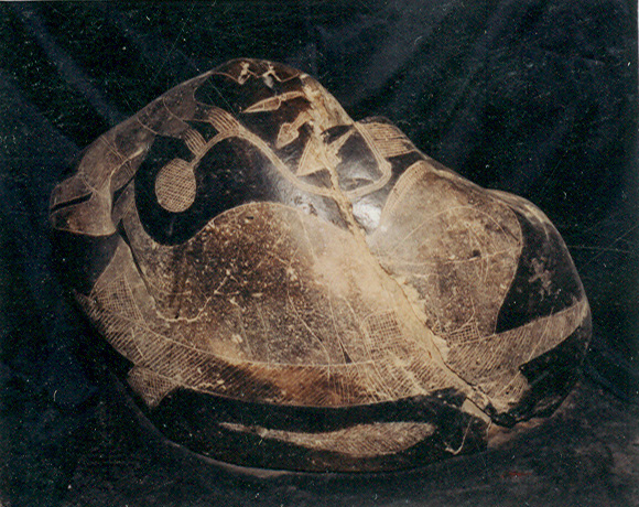 Head surgery, preparation of the
                            infusion 01