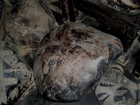 Heart surgery with a woman 01