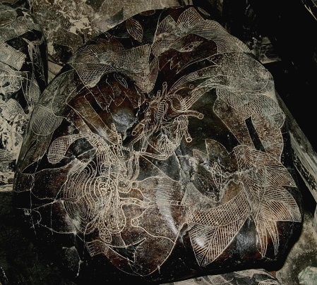 Heart surgery with a woman 02