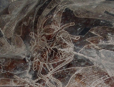 Heart surgery,
                  close-up of the heart 01