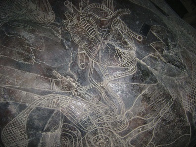 Heart surgery, close-up of the heart
                              and the cut