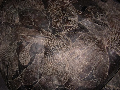 Heart surgery with a woman 04