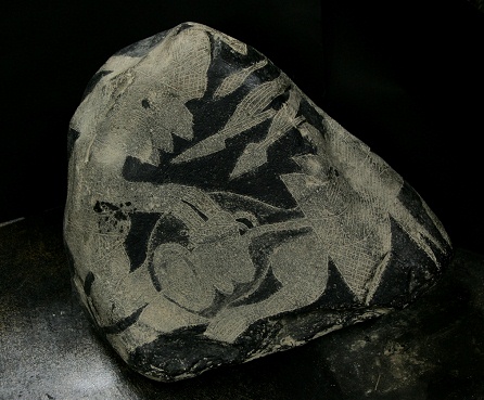 Heart surgery with a man 01a