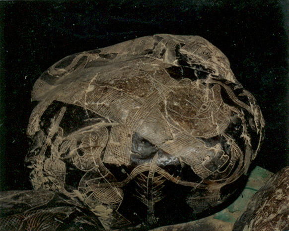 Heart surgery
                            with a man 05, the patient is fixed on the
                            operating table