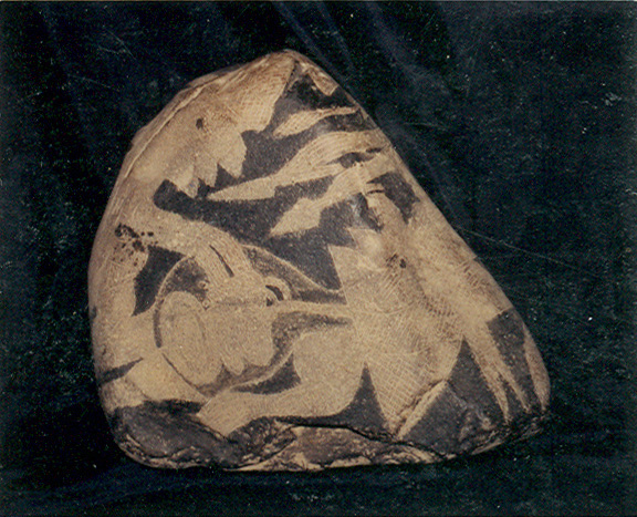 Heart surgery with a man 01b