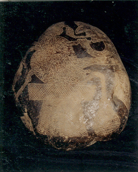 Heart surgery
                            with surgery operations at the heart,
                            close-up 02