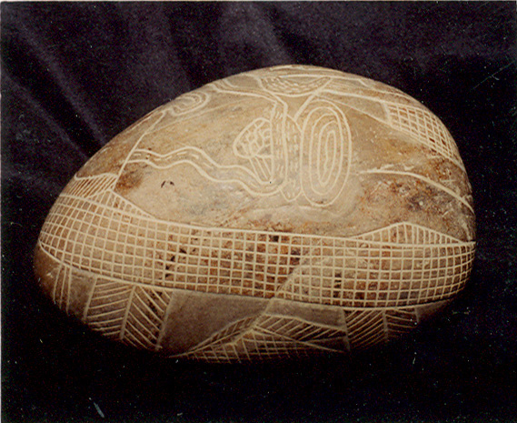 Stomach surgery,
                          lateral view of the organs