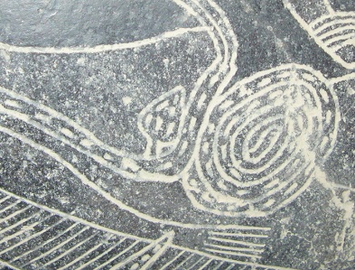 Stomach surgery, close-up