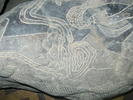 Stomach surgery, close-up