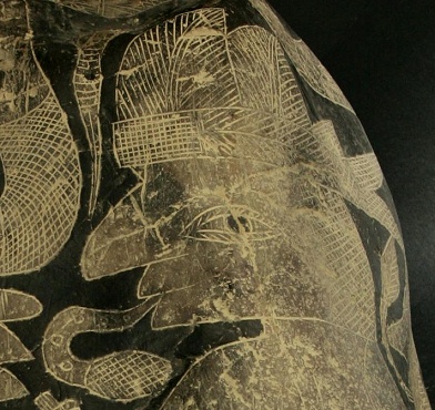 Cesarean with twins, the face of the
                            mother, close-up