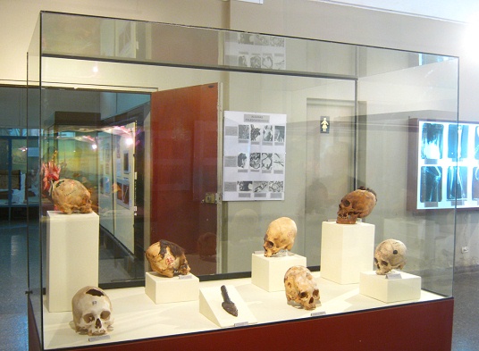 Vitrine mit aufgebohrten Sch�deln,
                            Nahaufnahme