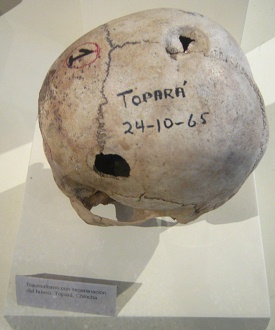 Aufgebohrter Sch�del 06, zweites
                                  Foto