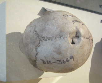 Aufgebohrter Sch�del 06, drittes
                                  Foto