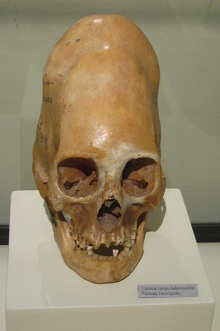 Deformierter Sch�del der
                                  Paracas-Kultur (Langsch�del) 03