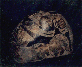 Kopfoperation, die
                                Markierung der Schnittstelle mit einem
                                Zirkel